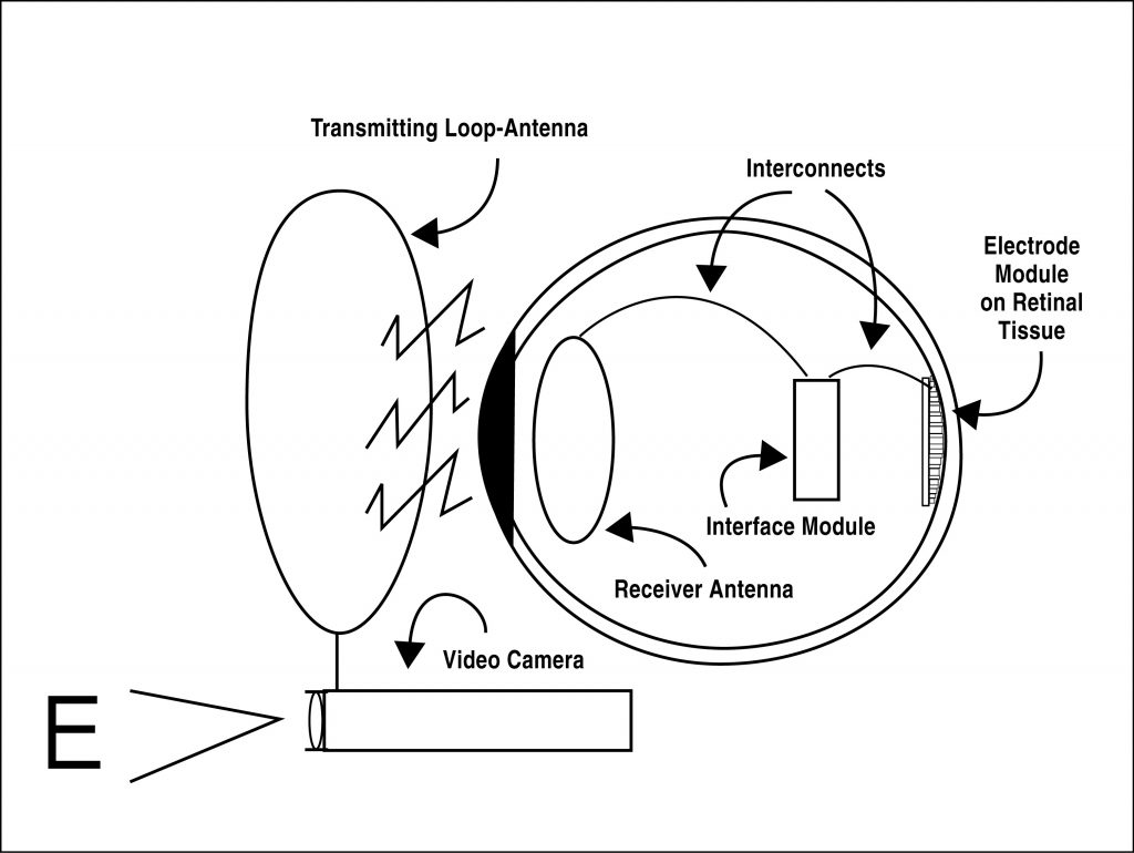 retinal prothesis drawing