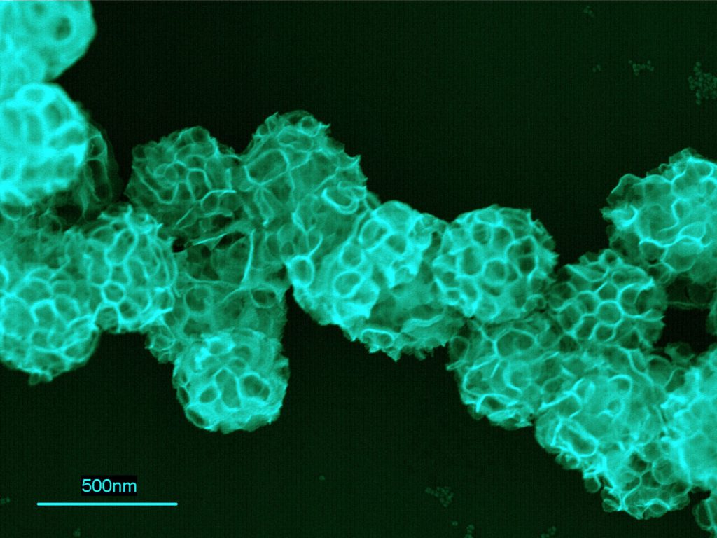 A SCANNING microscope image of platinum-lace nanoballs. Liposomes aggregate, providing a foamlike template for a platinum sheet to grow.