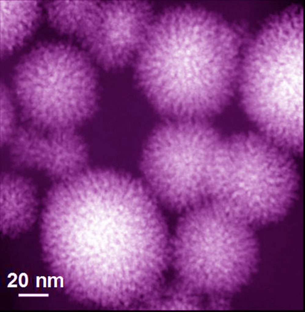 A TRANSMISSION electron microscope image of the platinum nano-Koosh balls. Sandia researchers use porphyrin molecules and light to grow seeds to allow the size of the nano-Koosh balls to be controlled.