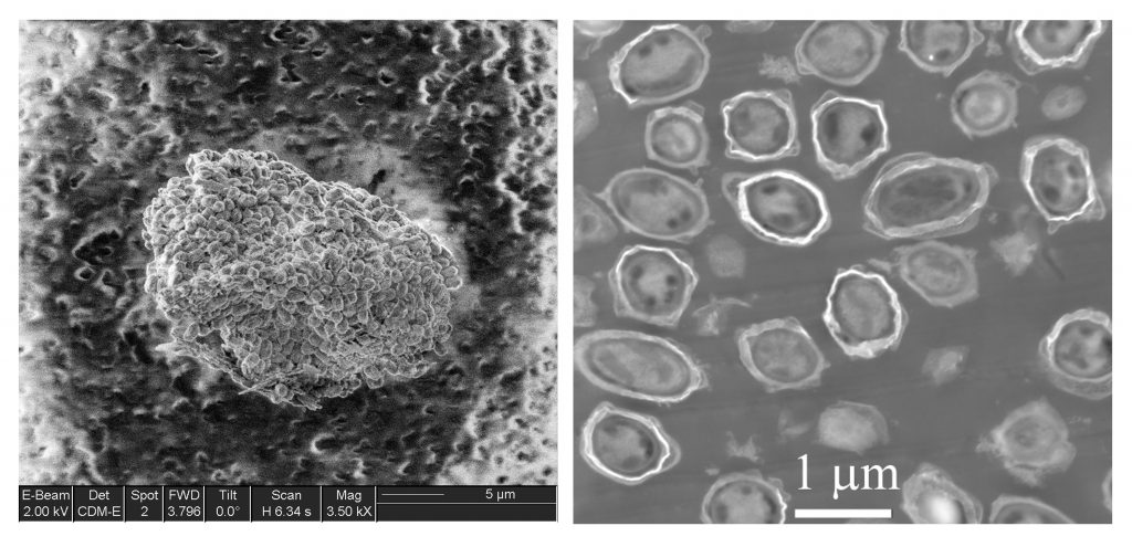 bacillus anthracis spores