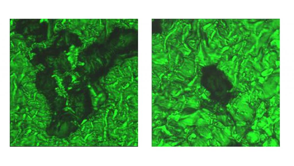 Topographical confocal projections of cells which have integrated onto predefined lipid-silica films. (The fuzzy, darker parts are the cells that have redistributed the green fluorescent lipid from the plane of the thin film into three dimensions around the cells)