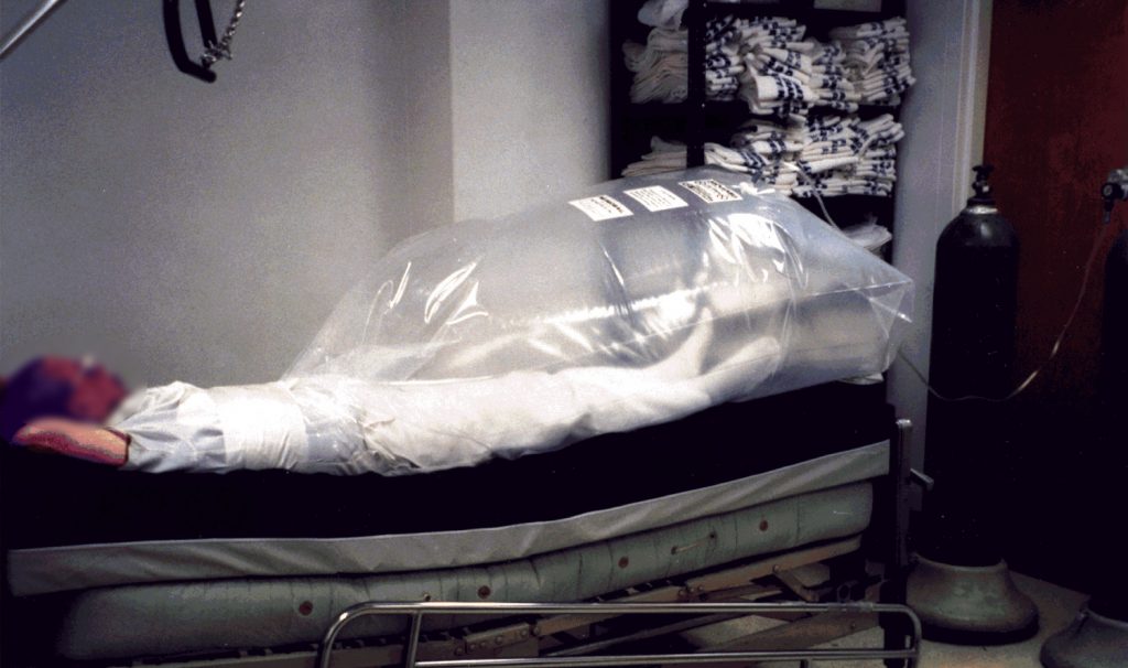 A hospital patient breathes ordinary air as his lower body is bathed in a low-pressure oxygen bath expected to stimulate healing. The container -- a thin plastic bag -- is cheap, simple, sanitary and disposable. Download 150dpi JPEG image, 'oxygen.jpg', 896K