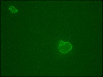 Glycosyl hydrolase 5 without CBM3b