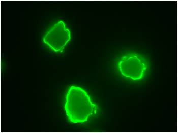 Glycosyl hydroase 5 with CBM3b 